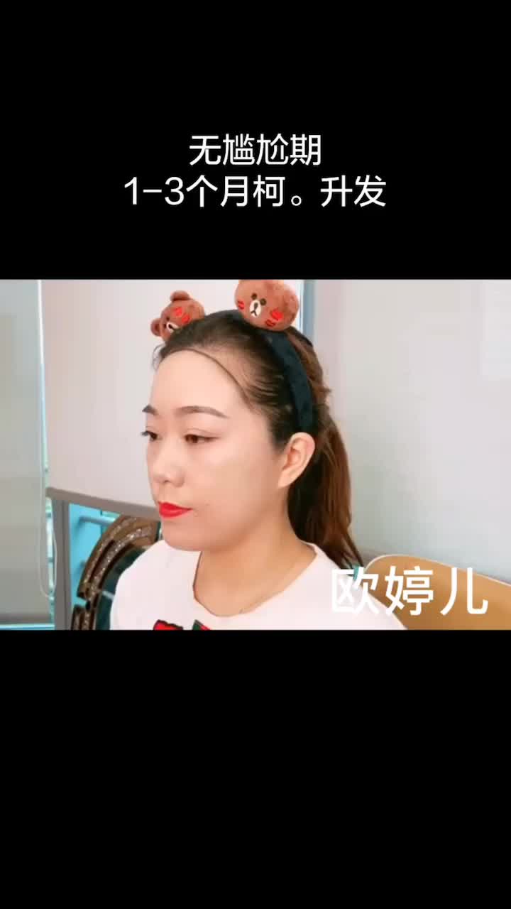 柯学习#掉发 #发际线 #抖音小助手 #挺住啊我的发际线