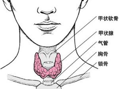 甲状腺炎症的症状与治疗方法