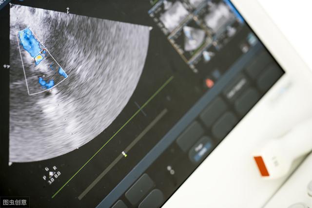 三维超声更能“深入”看透甲状腺腺瘤囊性变
