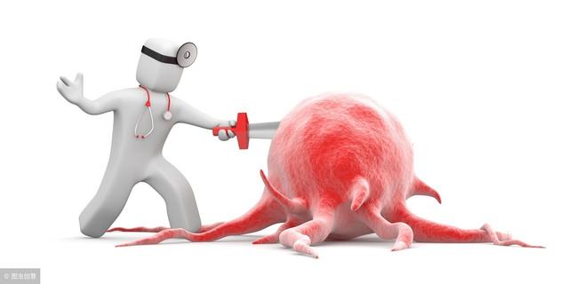 甲状腺微小癌可以消融吗？治疗甲状腺微小癌该如何选择治疗方式？