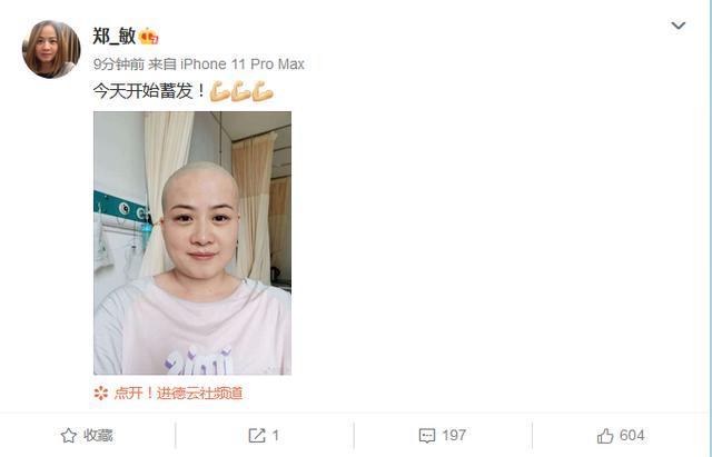 岳云鹏的妻子有多旺夫，她来了，他红了，而今她为啥要蓄发明志