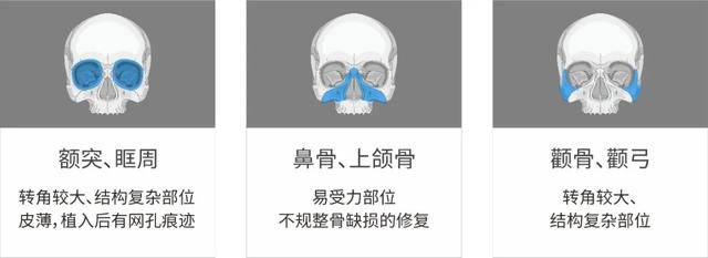 邁普醫(yī)學圍盧醫(yī)話第4期——腫瘤與顱底修復PEEK應用知多少？