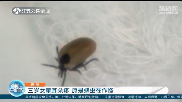 三岁女童耳朵疼 医生从耳道取出一只活蜱虫，还已经产卵