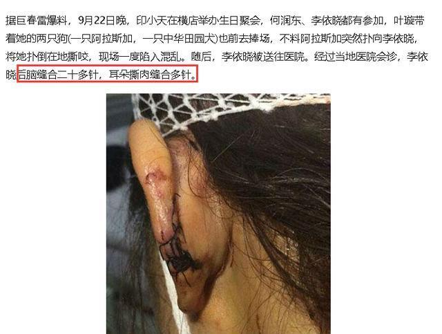 2014年，影星生日会上李依晓被叶璇的狗咬成重伤