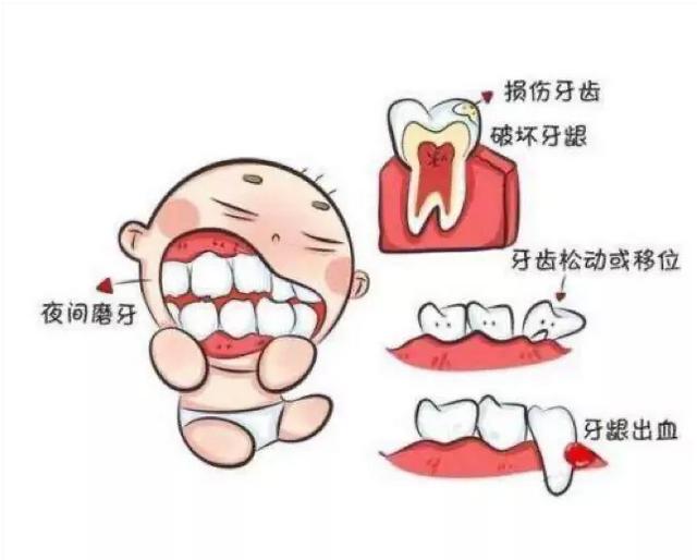 夜间磨牙，可能是身体发出的疾病信号