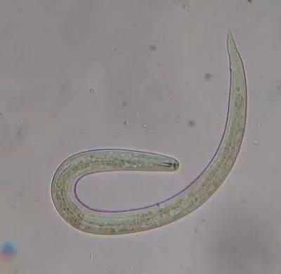 #入侵#福寿螺疯狂入侵洱海 这种外来物种可能你家乡也有