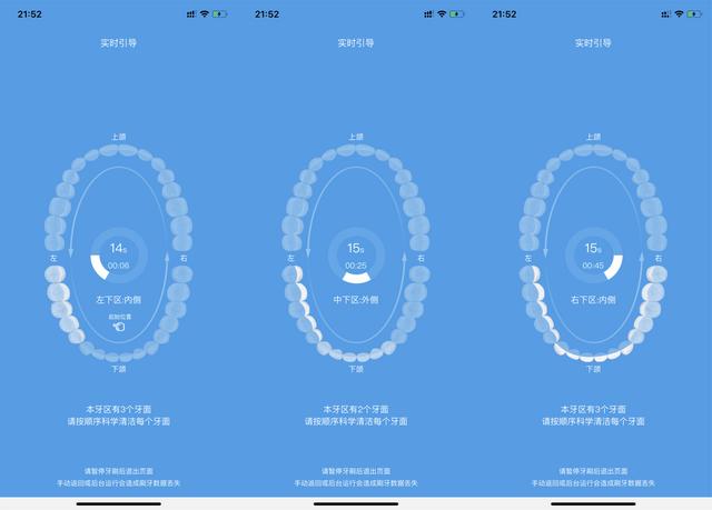 百元国货VS千元大牌：华为智选 力博得智能声波牙刷令你无法拒绝