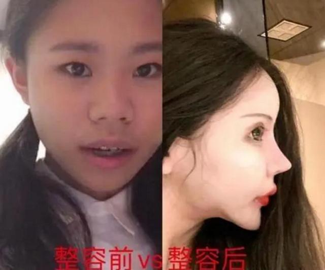 十六岁女孩三年时间整容60多次，成为网红遭到攻