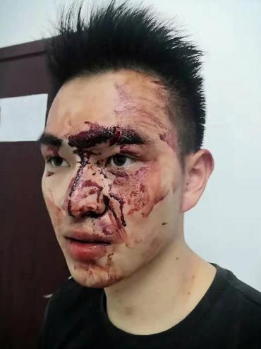 湖北武穴：郭林云与歹徒搏斗中3刀，两年从军，军魂入骨