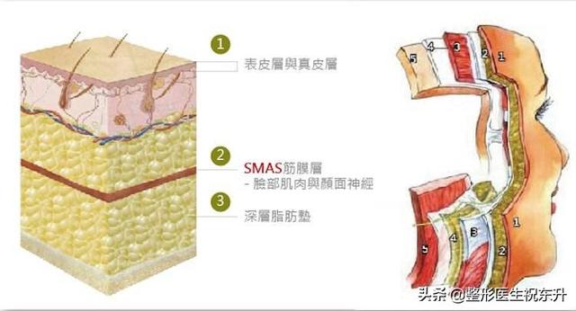 40岁以后脸松、塌、垂想变年轻，但这些项目可能不太适合你