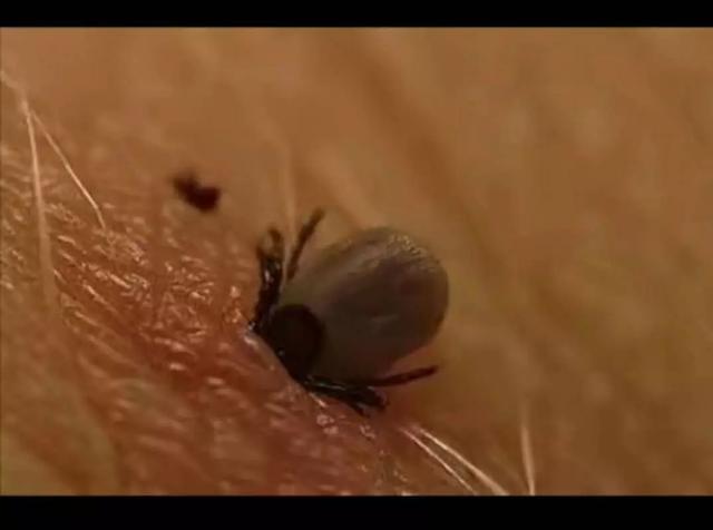 抚州人注意！近期高发！严重可致命