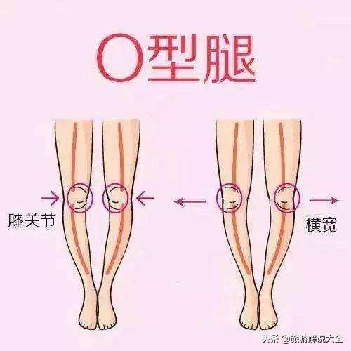 日本女孩为何大多都是“O型腿”？日本专家：与中国人有关系