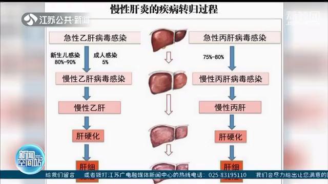 从肝炎到肝癌仅需三阶段 一起学学养肝“三字经”