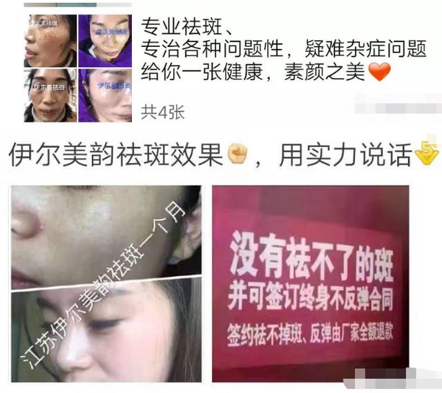 伊爾美虛假宣傳，造成消費者傷殘訴至法院被判巨額賠償
