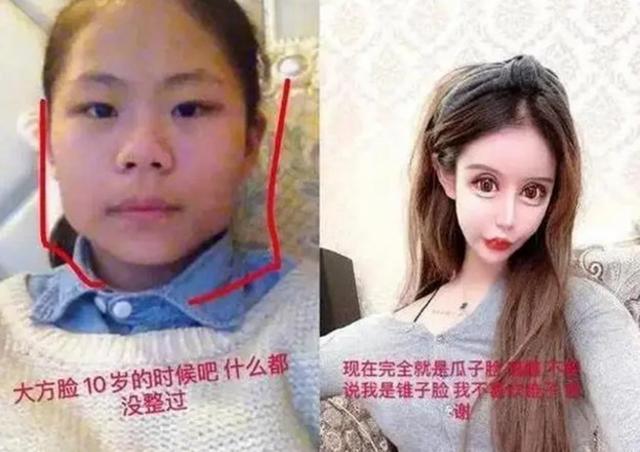 十六岁女孩三年时间整容60多次，成为网红遭到攻