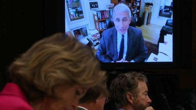 关键时刻，“美国钟南山”突然放出三个坏消息