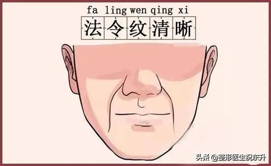 脸上有法令纹，最直观的感受就是：显老！医生给你支个招