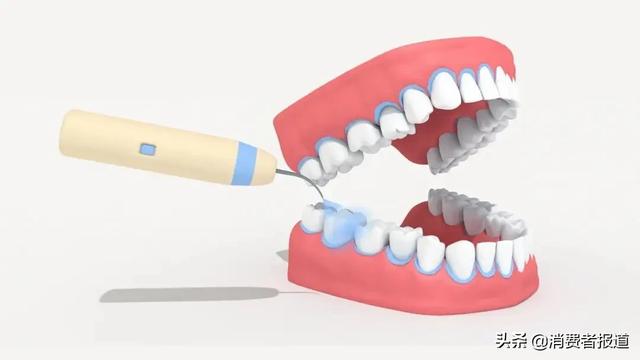 14款冲牙器实测：洁碧、素士、舒客等7款不达标 消费与科技 第6张