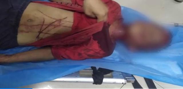 8岁男童电梯内被绑走毒打，男子打人后求饶，其母：希望重新给他一个机会