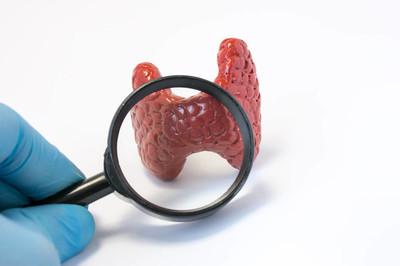 如何预防甲状腺肿大？这5个方法拿去不谢