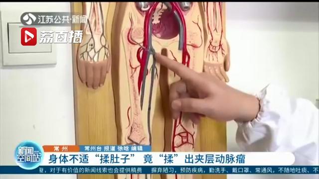 危险！不慎将一根血管壁揉破 女子身体不适揉肚子揉出夹层动脉瘤