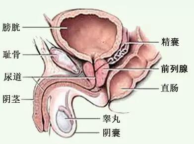 前列腺增生的术后指导及出院健康教育