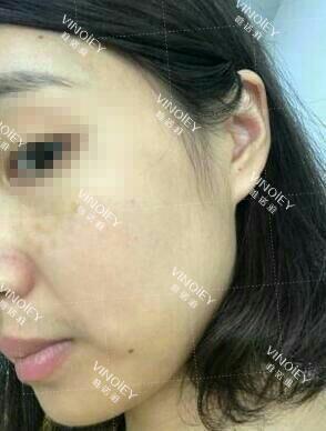 唯诺雅告诉大家：女性30+也会开始面临一个不可忽视的现象