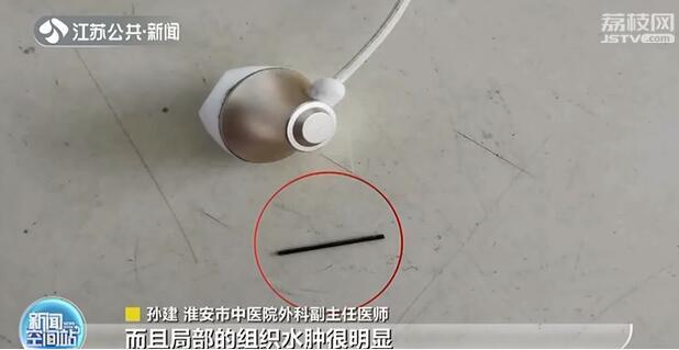 气钉枪突然“走火”两颗钉子射入男子体内