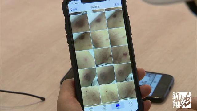 七旬丈夫为“美容”花掉576万！妻子崩溃：人搞