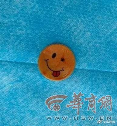 西安1岁女童口腔有贴画2周后发现，医生：幼儿禁