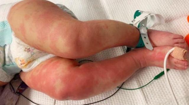 病毒变异？特朗普闯下大祸！美民众怒斥：救救