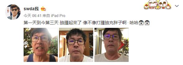 郭碧婷孕期在娘家安胎，大手笔出资赞助爸爸种牙，被夸是孝顺女儿