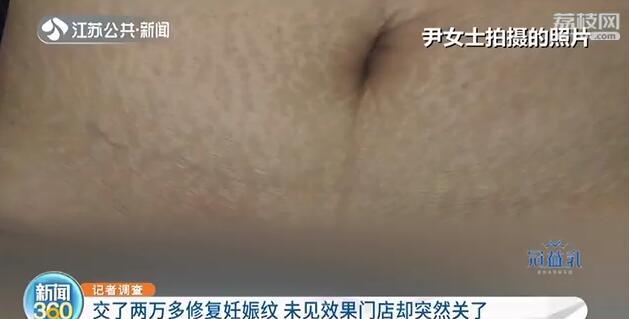 [妊娠纹]南京这家店却跑路了 坑人！花了2万元妊娠纹一点不见少