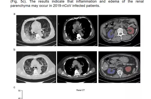 新冠后遗症大量涌现！重要器官严重损伤，揭开