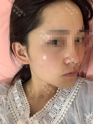 唯诺雅细数那些让人显老十岁的斑，你该怎么对付？