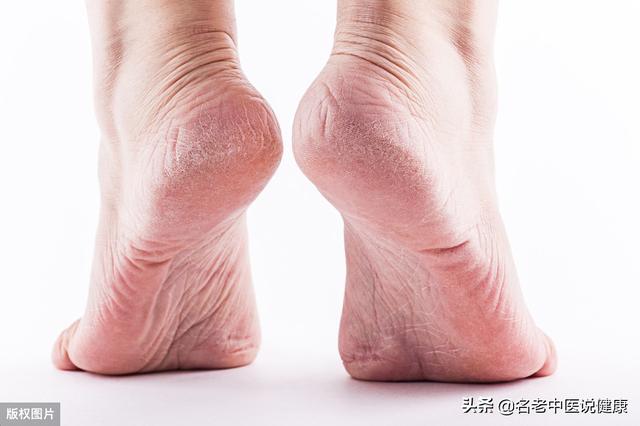 手脚经常性麻木，除了气血不畅外，警惕这5种疾病找上门
