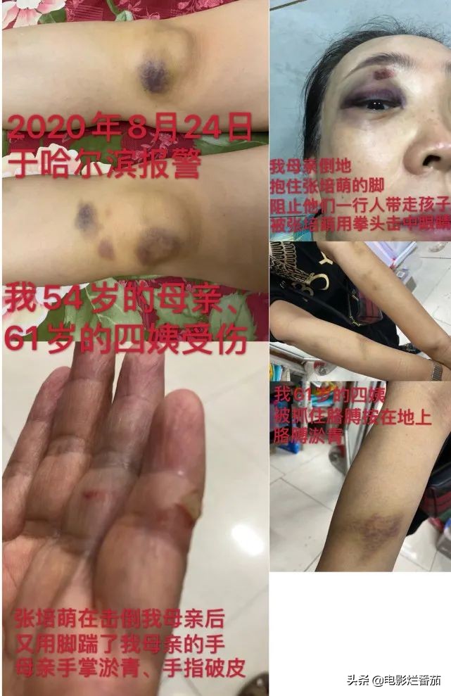 家暴、出轨...使张培萌夫妇成为全国性名人