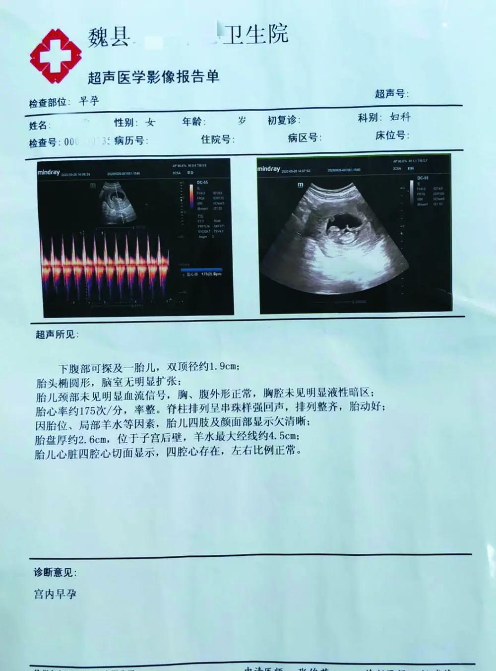 精神病女患者住院期间和男护工&quot;自愿&quot;发生关系怀孕？