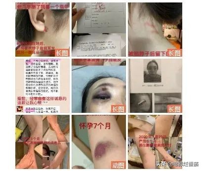 家暴、出轨...使张培萌夫妇成为全国性名人