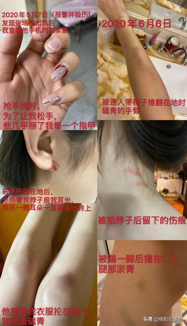 家暴、出轨...使张培萌夫妇成为全国性名人