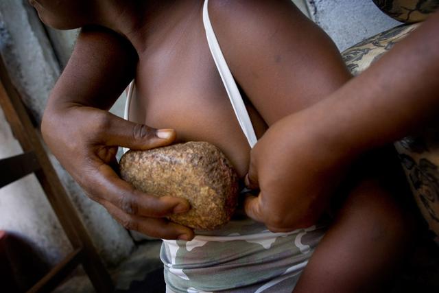 非洲女孩满十岁就必须要用炙热石头把乳房烧坏，而加害者竟是母亲