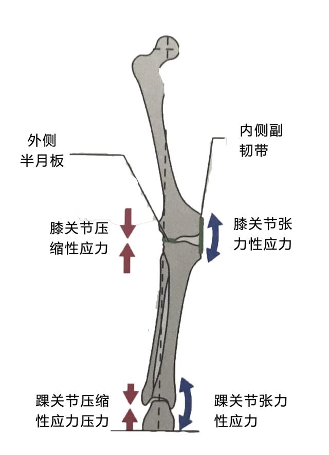 5招改善X形腿，今夏秀出氣質美腿