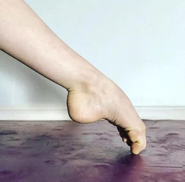 科普光脚丫跳芭蕾的小女孩芭蕾脚的真相