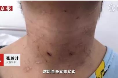 将4岁女童打到多器官衰竭，这样的继母也配当人？