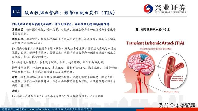 神经介入器械投资策略：百亿市场尚处起步期，国产替代潜力巨大