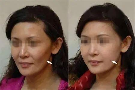 8cb8157344bf48f2b8a2646346e914a6?from=pc