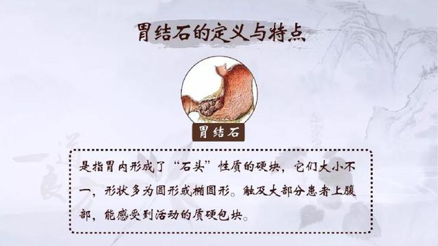 山楂开胃，柿子美味，但都容易引起胃结石！中医药方与按摩方子教你保守治疗