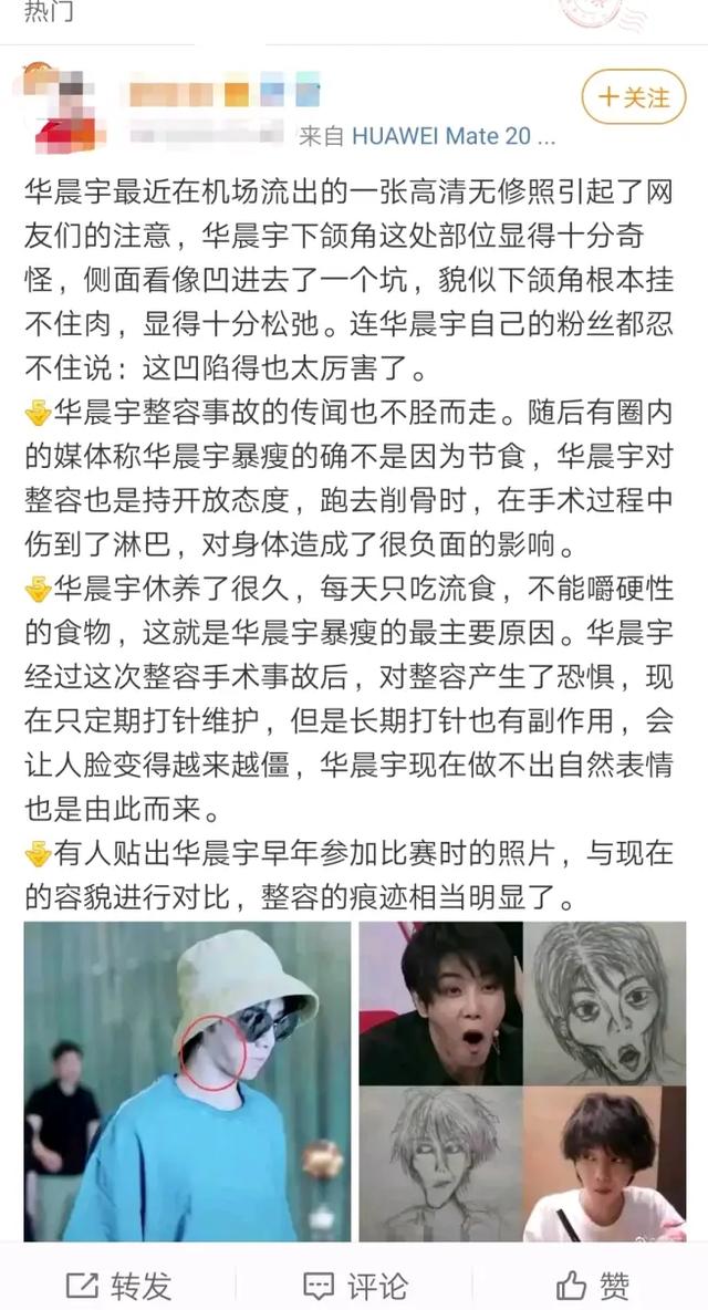 华晨宇整容失败恐成削古天帝？自肖战整容之后