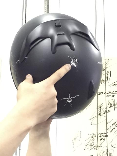 ��������ͷ�󺹣��ļ����ķ�֮��ͷ����ס��5��