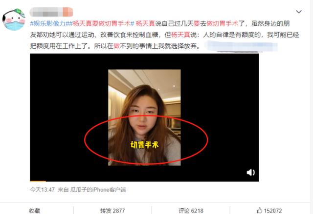 回应|杨天真回应要做切胃手术 对自己外形很满意只是做微创手术